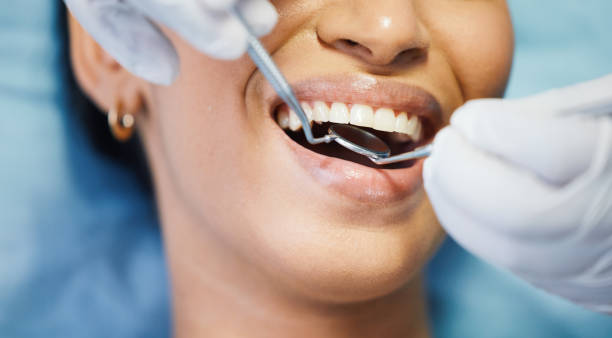 Best Emergency Dental Care for Sports Injuries in Bunk Foss, WA